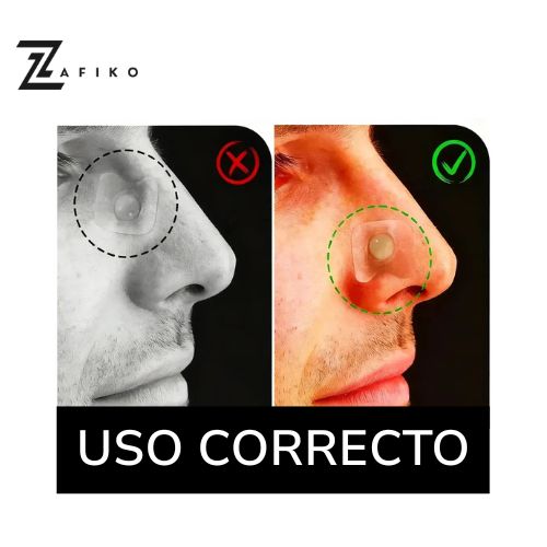 Kit de Tiras Magneticas Para Fosas Nasales   +  Tiras Adhesivas